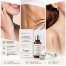 SÉRUM para Tratamento de cicatrizes antigas e recentes, redução de cicatrizes cirúrgicas, estrias, queloides, acne, queimaduras, verrugas, dermátomos e varizes