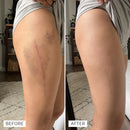 Timilk® BruiseFade Pro – Creme para Eliminar Hematomas, Reduzir Manchas Roxas e Acelerar a Recuperação da Pele