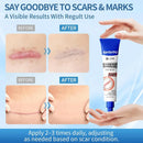 Gel de Silicone para Cicatrizes | Reduz Marcas de Acne, Estrias, Quelóides e Cicatrizes Cirúrgicas