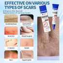 Gel de Silicone para Cicatrizes | Reduz Marcas de Acne, Estrias, Quelóides e Cicatrizes Cirúrgicas