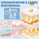 Gel de Silicone para Cicatrizes | Reduz Marcas de Acne, Estrias, Quelóides e Cicatrizes Cirúrgicas