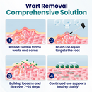 Timilk WartLift Corn Removal Liquid - removedor líquido para: Calos, Verrugas, Calosidades, Verrugas plantares (olho de peixe)