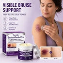 Timilk® BruiseFade Pro – Creme para Eliminar Hematomas, Reduzir Manchas Roxas e Acelerar a Recuperação da Pele