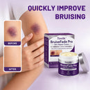 Timilk® BruiseFade Pro – Creme para Eliminar Hematomas, Reduzir Manchas Roxas e Acelerar a Recuperação da Pele