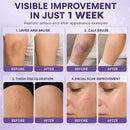 Timilk® BruiseFade Pro – Creme para Eliminar Hematomas, Reduzir Manchas Roxas e Acelerar a Recuperação da Pele