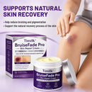 Timilk® BruiseFade Pro – Creme para Eliminar Hematomas, Reduzir Manchas Roxas e Acelerar a Recuperação da Pele