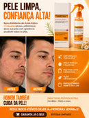 Spray Esfoliante Corporal com Ácido Kójico e Cúrcuma